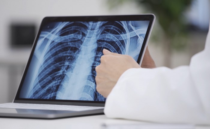 Рентген грудной клетки: цены в Москве – адреса, отзывы | Сделать рентгенографию органов грудной клетки Рентген грудной клетки: цены в Москве – адреса, отзывы | Сделать рентгенографию органов грудной клетки