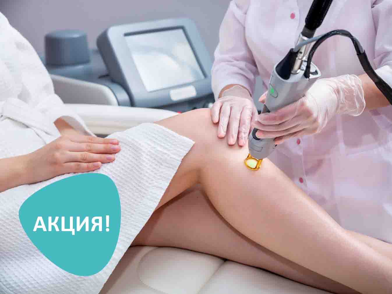 Скидка 30% на лазерную эпиляцию акция завершена