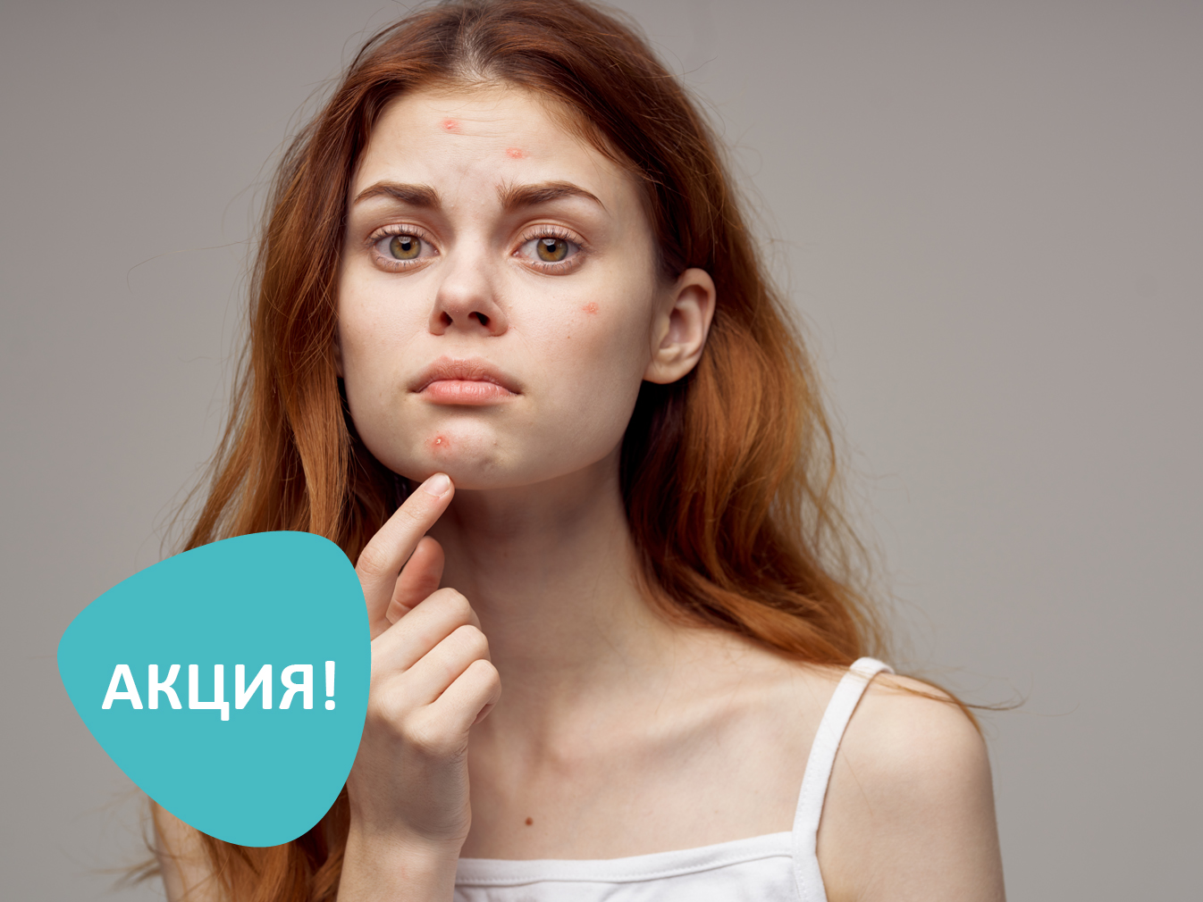 Анти-Акне комплекс со скидкой 30% - Чистая кожа за месяц!